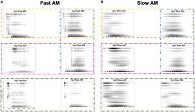 An auditory perspective on phonological development in infancy